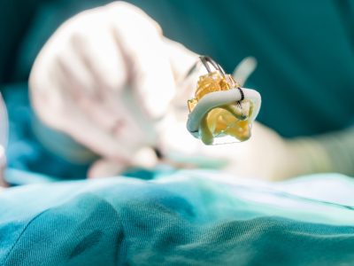 Aortic valve implant. Close up vew on artificial heart prosthesis